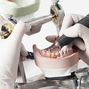 مراحل ساخت پروتز ثابت دندان چیست