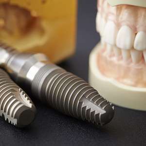 آیا ایمپلنت دندان سرطان زاست