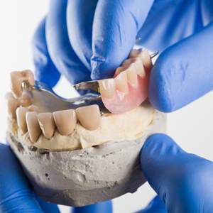 تفاوت دندان مصنوعی ثابت و متحرک