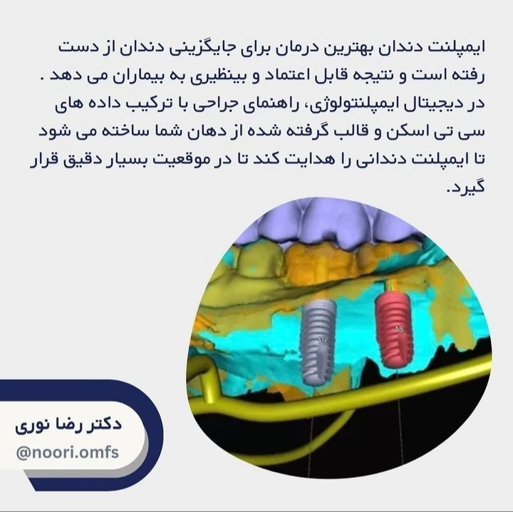 دیجیتال ایمپلنتلوژی در مرکز تخصصی ایمپلنت