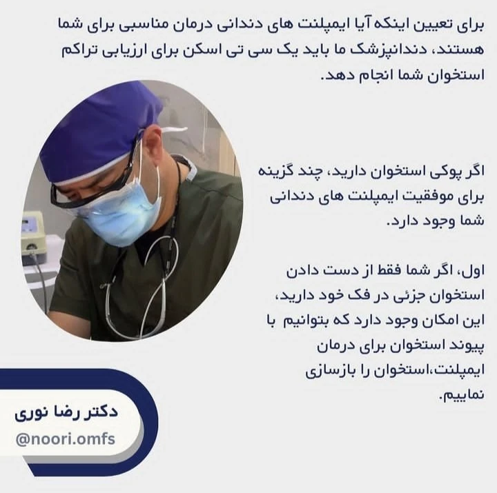ارتباط بین ایمپلنت دندان و پوکی استخوان چیست؟