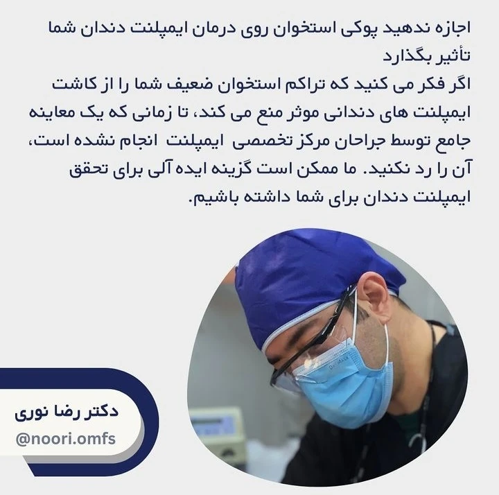 ارتباط بین ایمپلنت دندان و پوکی استخوان چیست؟