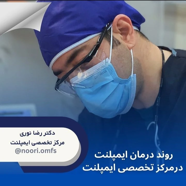 روند درمان ایمپلنت در مرکز ایمپلنت تهران