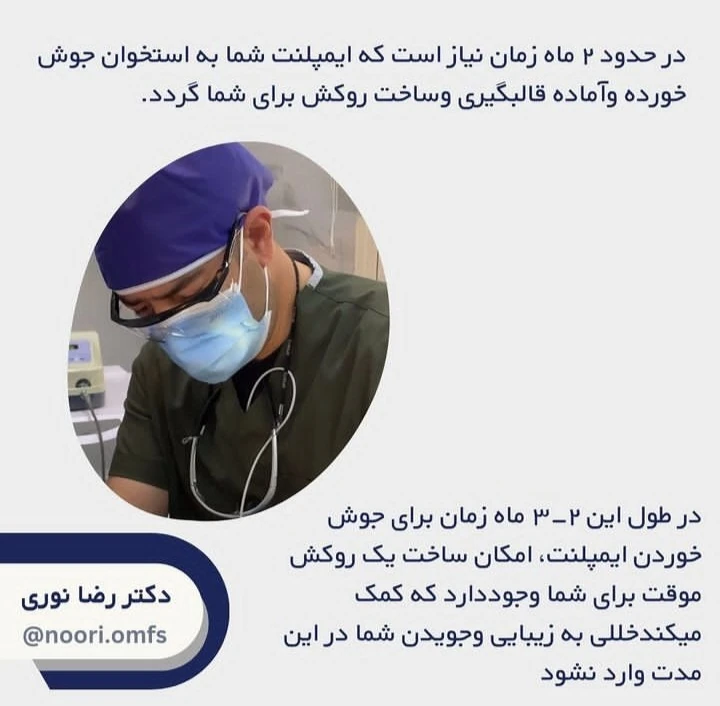 روند درمان ایمپلنت در مرکز ایمپلنت تهران