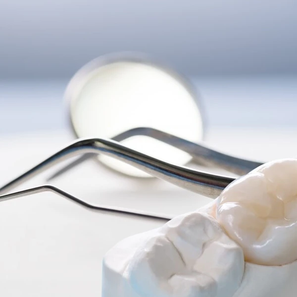 دندان مصنوعی بهتر است یا ایمپلنت