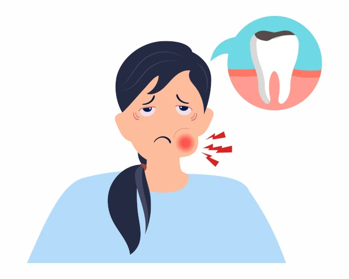آیا عفونت دندان عقل باعث گلو درد می‌شود - علائم