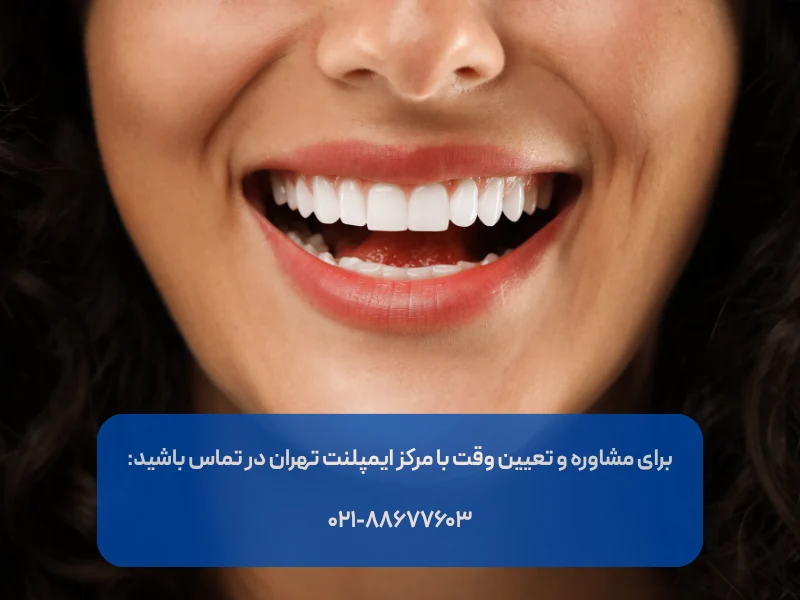 دندان ایمپلنت چند سال دوام دارد