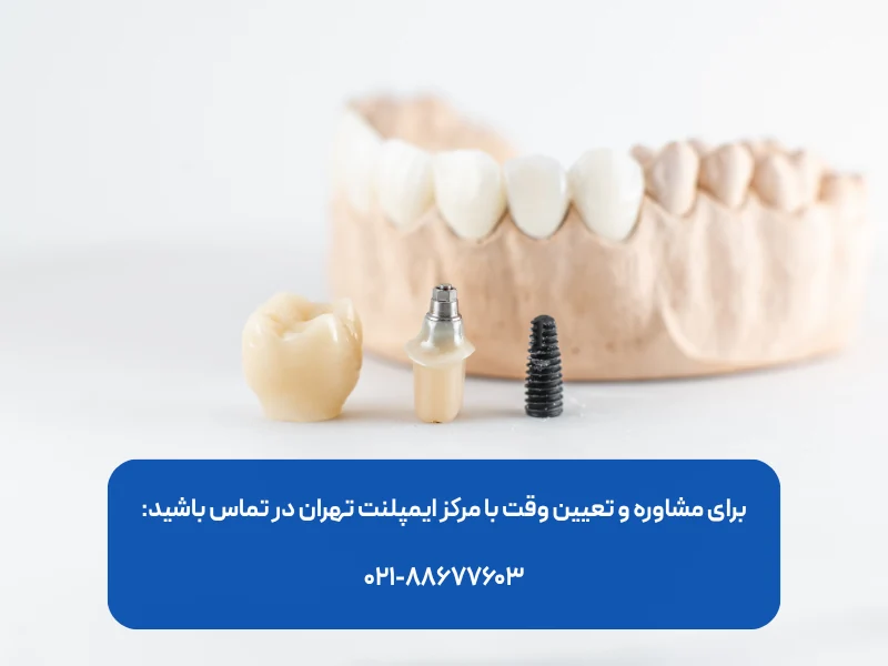 بهترین متخصص ایمپلنت دندان در ونک