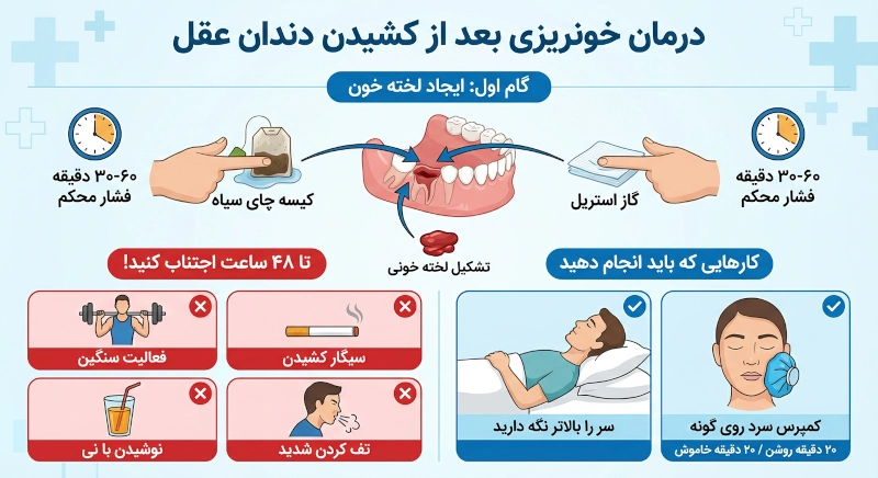 درمان خونریزی بعد از کشیدن دندان عقل