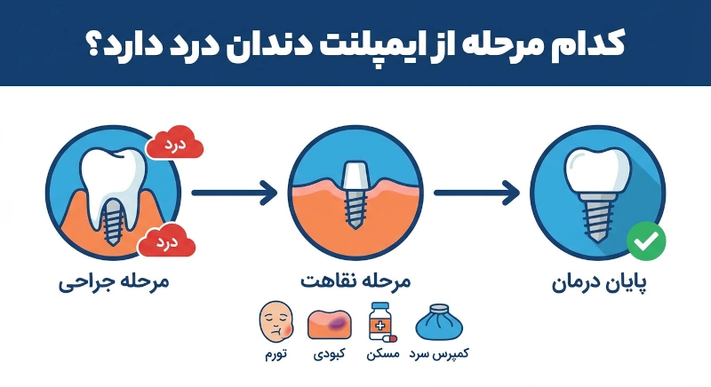 کدام مرحله ایمپلنت درد دارد